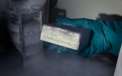 A Promise Fulfilled: 15 Years After Paul Poth’s Vision, a New Era in Cholangiocarcinoma Research Begins